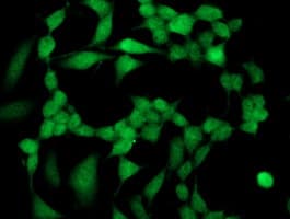 SIRT5 / Sirtuin 5 Antibody (clone OTI1A6, Carrier-free)