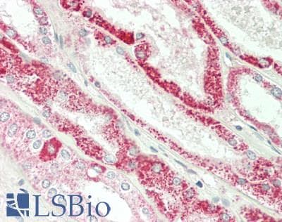 IHC-plus™ TGFA / TGF Alpha Antibody