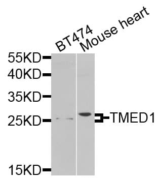 Polyclonal Rabbit anti-Human TMED1 / ST2L Antibody (WB)