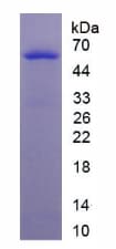 Human CD83 Protein (Recombinant His-GST)