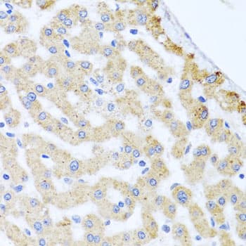 Polyclonal Rabbit anti-Human CETN3 Antibody (IHC, WB)