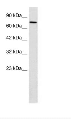 WHSC1 / NSD2 Antibody (aa219-268)