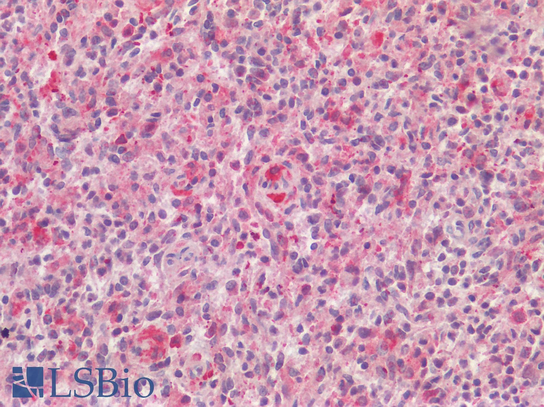 IHC-plus™ Polyclonal Rabbit anti-Human AIF1 / IBA1 Antibody (N-Terminal, IHC)