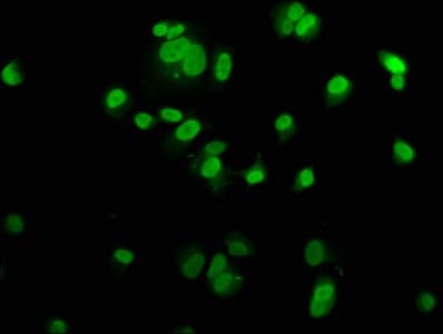 IHC-plus™ Polyclonal Rabbit anti-Human MCM2 Antibody (IHC, WB)