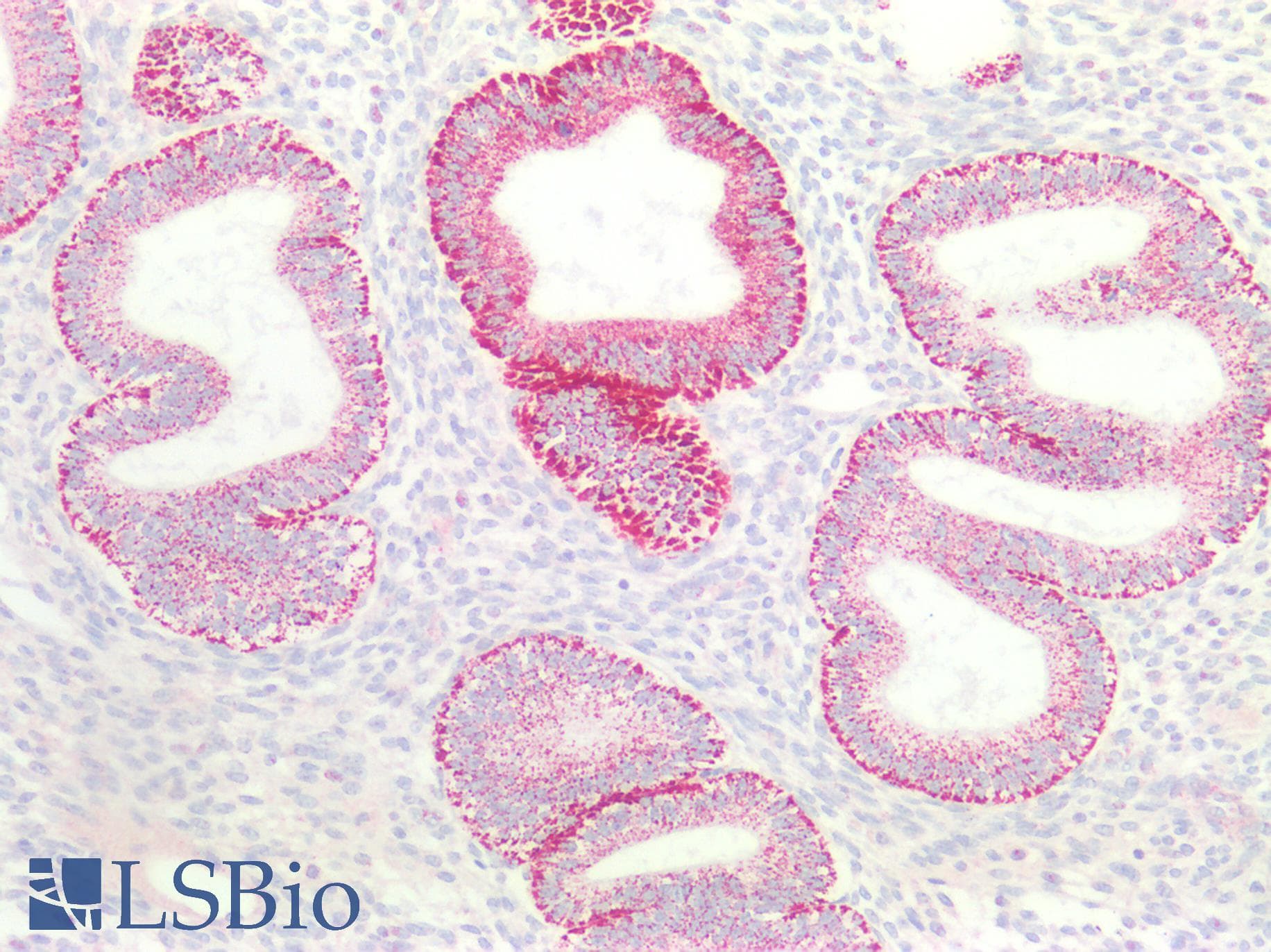 PathPlus™ BCKDHA / BCKDE1A Antibody