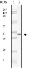 SARS-CoV Matrix Antibody (clone 2H2C4)