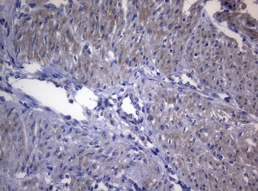 RAB3A Antibody (clone OTI1G3)