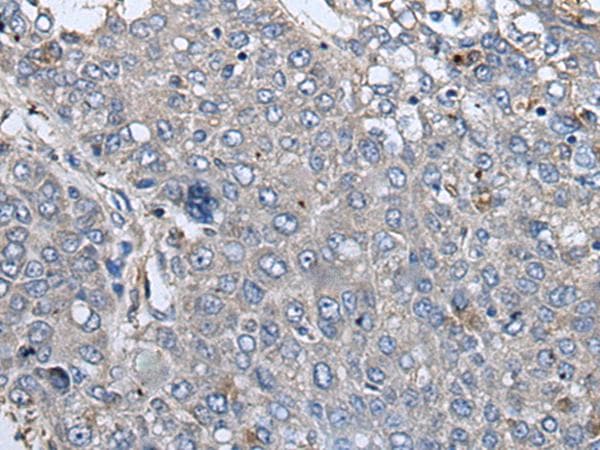 RIPK1 / RIP Antibody