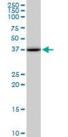 ACOT7 / BACH Antibody (clone 1E7)