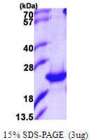 Human PTGES2 Protein (Recombinant His)