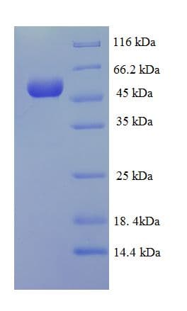 Human UBE2Q2 Protein (Recombinant His-SUMO)