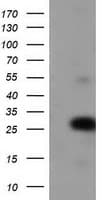 ZFAND2B Antibody (clone OTI2E4)