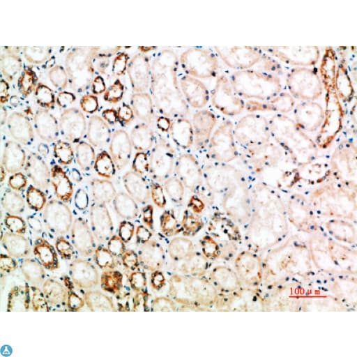 Polyclonal Rabbit anti-Human CTLA4 / CD152 Antibody (IHC)