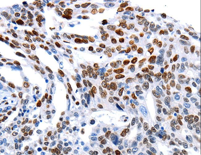 MUTYH / MYH Antibody