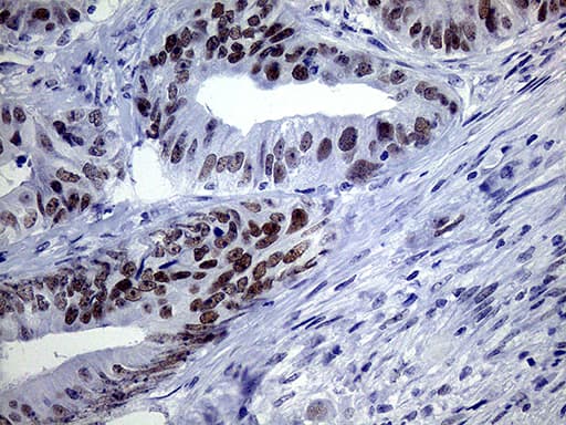 TSEN34 Antibody (clone OTI6B3)