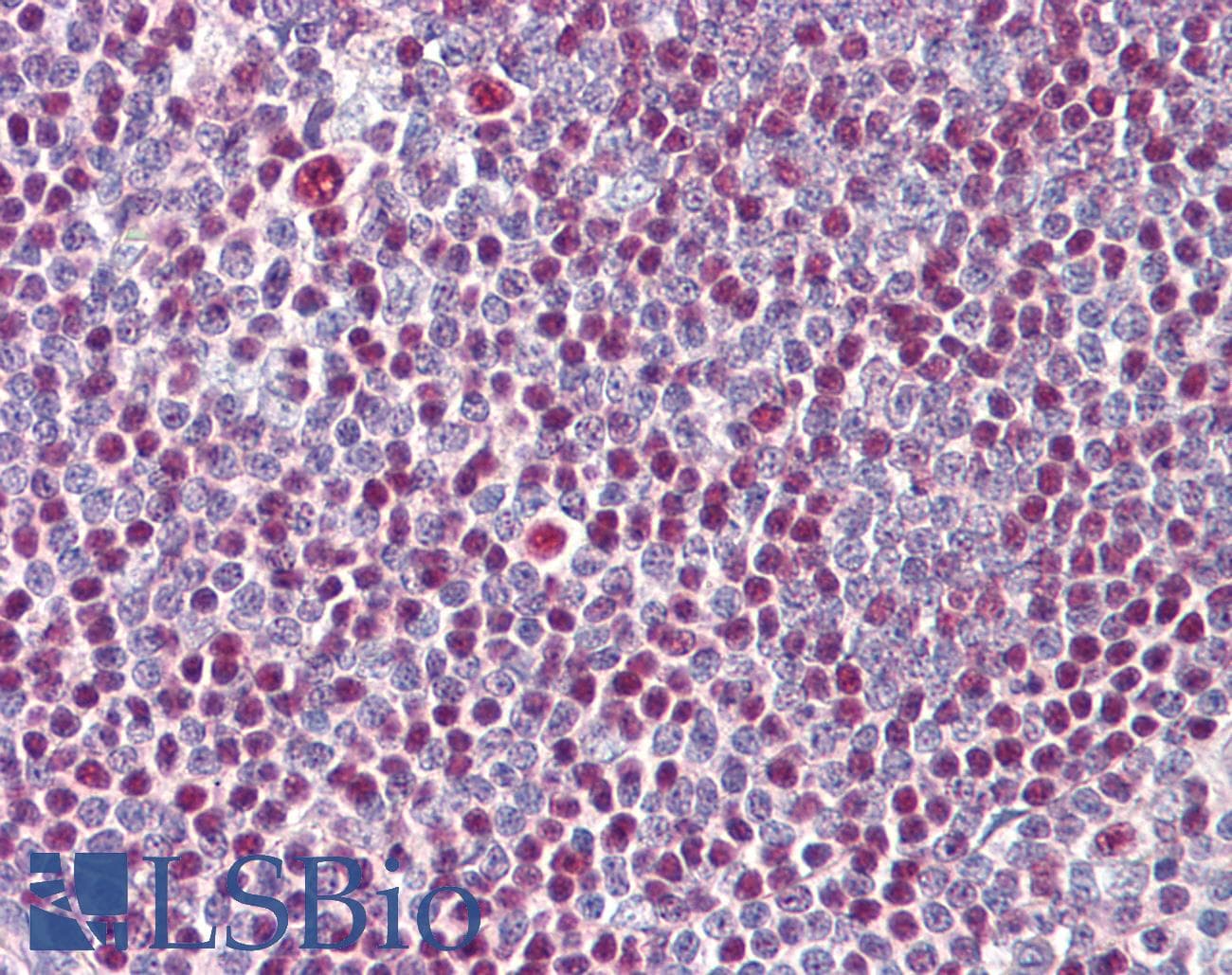 IKZF3 / AIOLOS Antibody (N-Terminus)