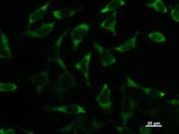 DDX3 / DDX3X Antibody (clone 2253C5a)