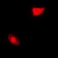SGTA / SGT Antibody