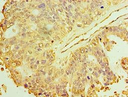 MAP2K3 / MEK3 / MKK3 Antibody (aa1-170)