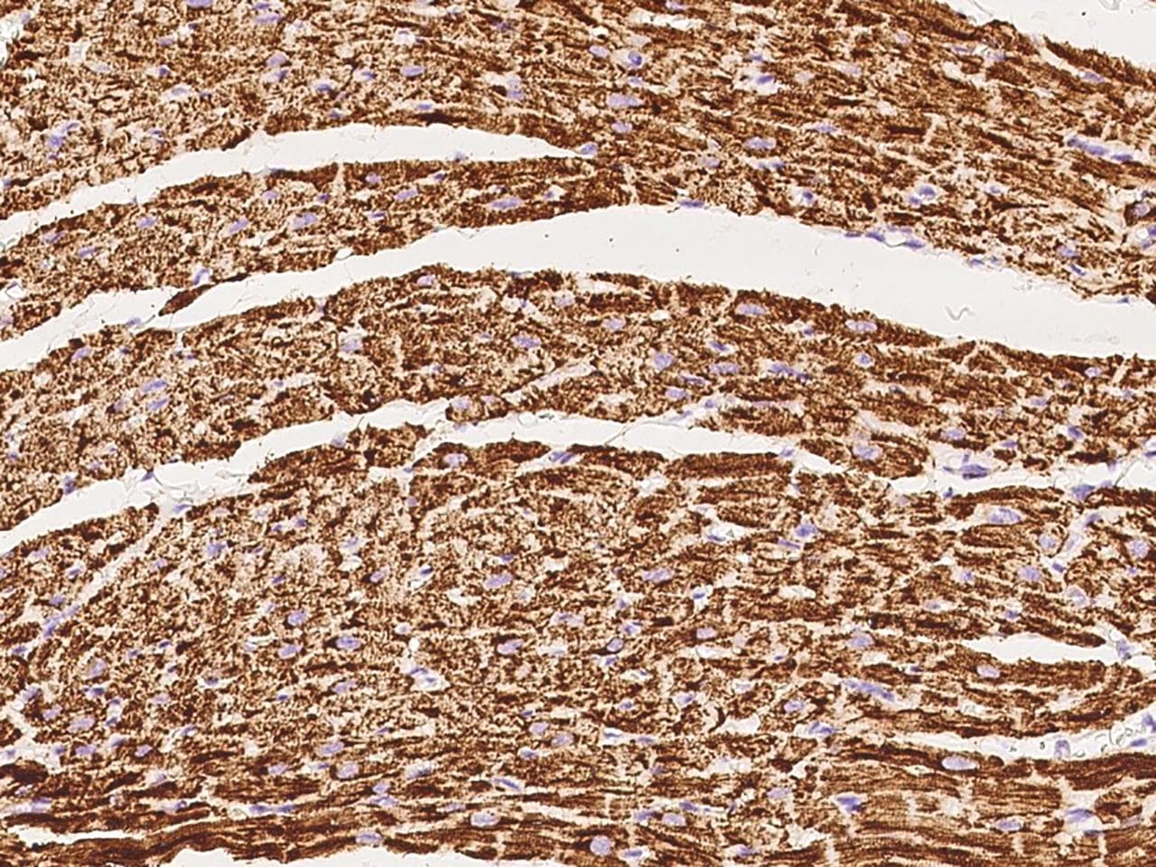 Polyclonal Rabbit anti-Human VDAC2 Antibody (IHC, IF, WB)