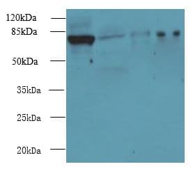 CLPB Antibody