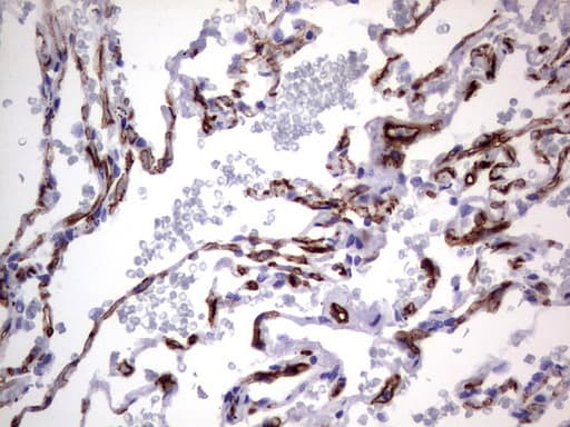 Monoclonal Mouse anti-Human MCAM / CD146 Antibody (clone UMAB155, Carrier-free, IHC, WB)