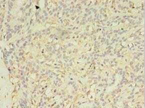 EXOSC5 Antibody