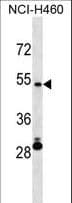 Polyclonal Rabbit anti-Human IRX6 Antibody (aa260-288, WB)