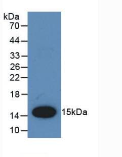 CCL2 / MCP1 Antibody (aa24-148)