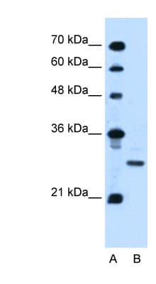 PDPN / Podoplanin Antibody (aa97-146)