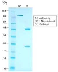 KRT7 / CK7 / Cytokeratin 7 Antibody (clone rOV-TL12/30, Azide-free, Carrier-free)