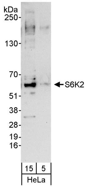 RPS6KB2 / S6K2 Antibody (aa430-C-term)