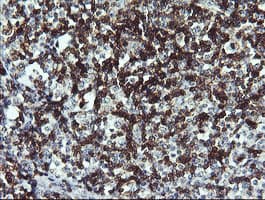 CD45 / LCA Antibody (clone OTI2F1)