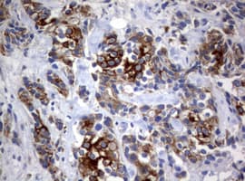 Monoclonal Mouse anti-Human BNIP1 Antibody (clone OTI2B3, aa1-199, IHC, WB)