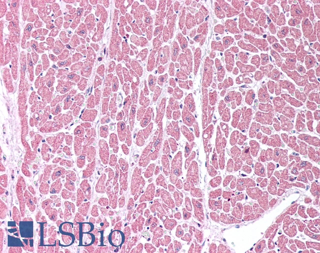 IHC-plus™ COL15A1 / Collagen XV Alpha 1 Antibody (C-Terminus)