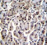 Polyclonal Rabbit anti-Human MESP1 Antibody (aa46-75, IHC, WB)