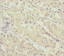 SOCS4 Antibody