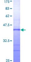 Human ADAR2 / ADARB1 Protein (Recombinant GST, N-terminus)