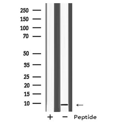Polyclonal Rabbit anti-Human MRPL33 Antibody (WB)