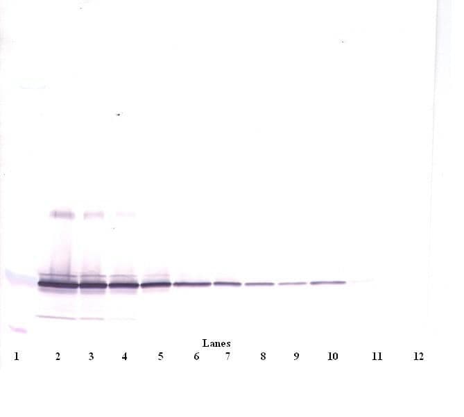 IL11 Antibody