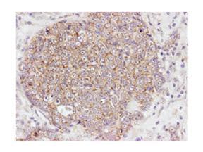 AKT1 + AKT2 + AKT3 Antibody (phospho-Ser473)