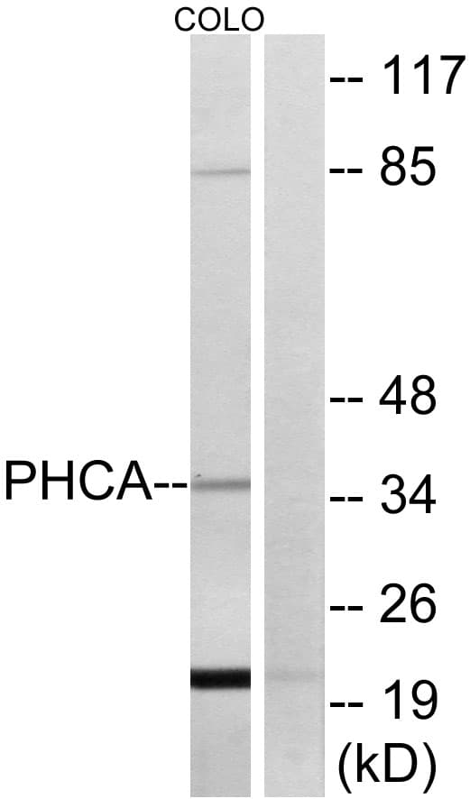 ACER3 Antibody (aa171-220)