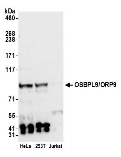 Polyclonal Rabbit anti-Human OSBPL9 Antibody (aa686-736, WB)