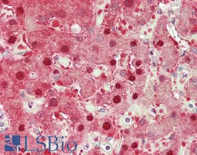 PathPlus™ ARG1 / Arginase 1 Antibody (aa11-97, clone ABM4B35)