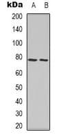 FOXO1 / FKHR Antibody (phospho-Ser256)