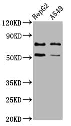 ACRC Antibody