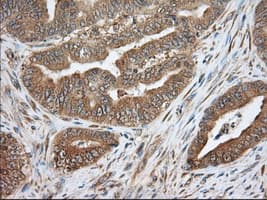Monoclonal Mouse anti-Human PDE4A / PDE4 Antibody (clone OTI2G2, IHC, IF, WB)