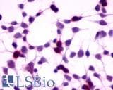 IHC-plus™ Polyclonal Rabbit anti-Human GPRC5A / RAI3 Antibody (N-Terminus, IHC)