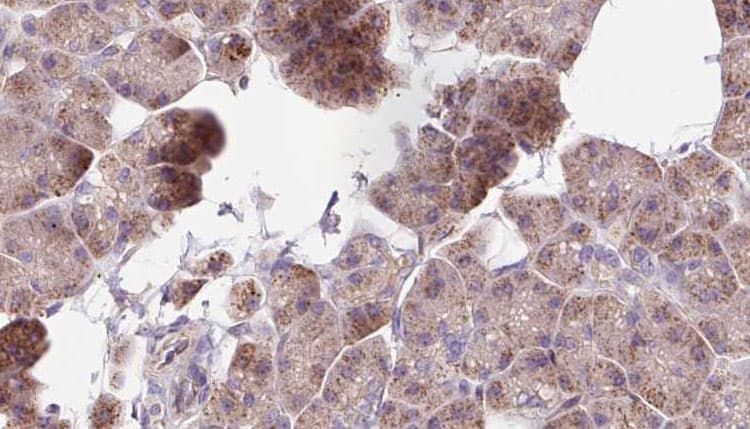 MAP1B Antibody