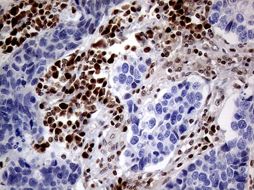 Monoclonal Mouse anti-Human MGMT Antibody (clone OTI6G6, Carrier-free, IHC, WB)